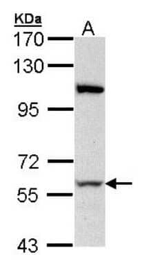 Western Blot: RPA70 Antibody [NBP2-20206]