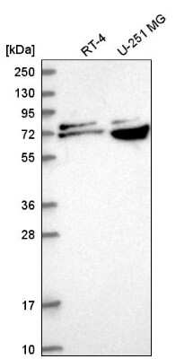 Western Blot: RPA70 Antibody [NBP2-55485]