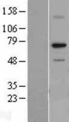 Western Blot: RPA70 Overexpression Lysate [NBL1-15488]