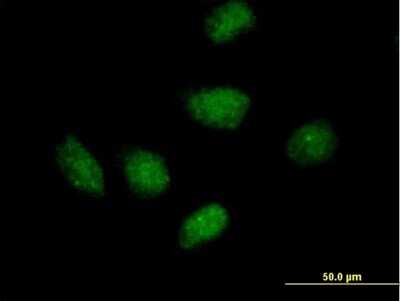 Immunocytochemistry/ Immunofluorescence: RPAIN Antibody [H00084268-B01P]