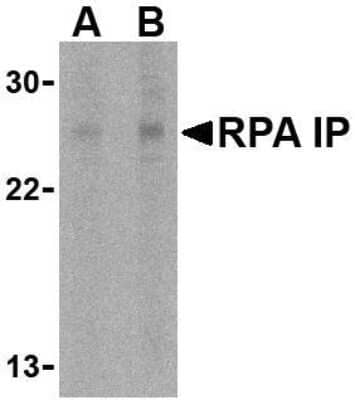 Western Blot: RPAIN AntibodyBSA Free [NBP1-76749]