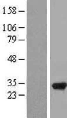 Western Blot: RPAIN Overexpression Lysate [NBL1-15492]