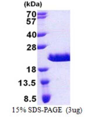 SDS-PAGE: Recombinant Human RPAIN His Protein [NBP2-23447]