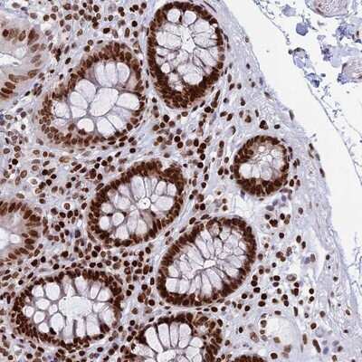 Immunohistochemistry-Paraffin: RPAP1 Antibody [NBP2-14512]