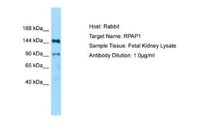 Western Blot: RPAP1 Antibody [NBP2-83464]