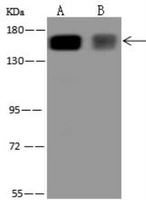 Western Blot: RPAP1 Antibody [NBP3-12623]