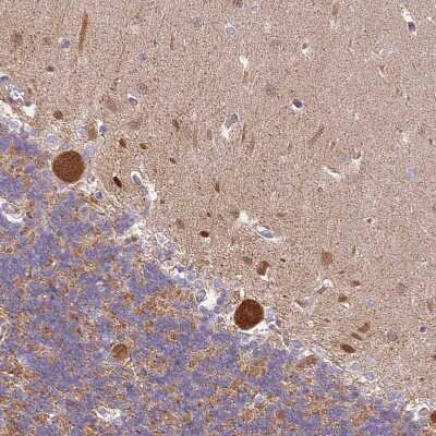 Immunohistochemistry-Paraffin: RPAP2 Antibody [NBP2-13248]