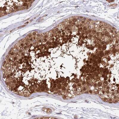 Immunohistochemistry-Paraffin: RPAP2 Antibody [NBP2-13248]