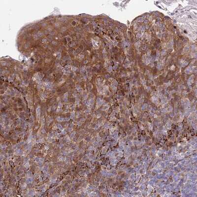 Immunohistochemistry-Paraffin: RPAP2 Antibody [NBP2-13248]