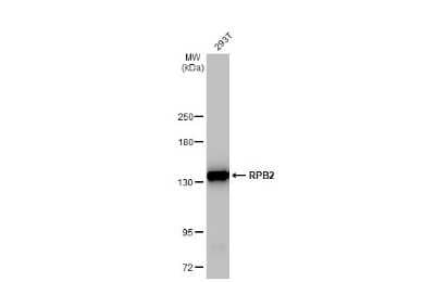 Western Blot: RPB2 Antibody (HL1042) [NBP3-13697]