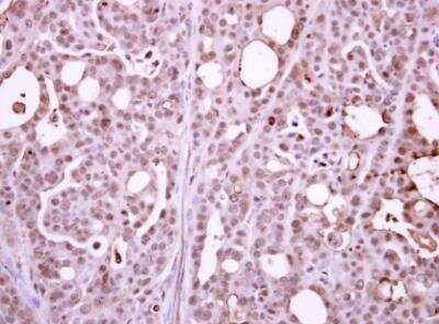 Immunohistochemistry-Paraffin: RPB2 Antibody [NBP2-53092]