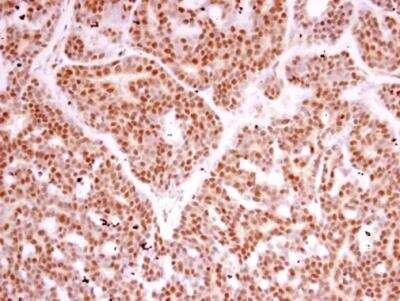 Immunohistochemistry-Paraffin: RPB2 Antibody [NBP2-53092]