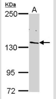 Western Blot: RPB2 Antibody [NBP2-53092]