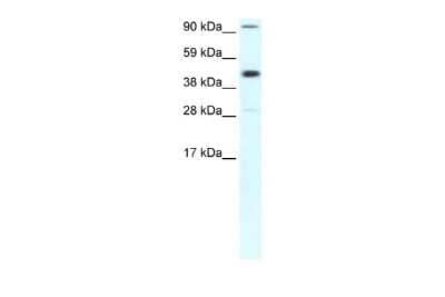 Western Blot: RPB2 Antibody [NBP2-88175]