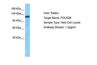 Western Blot: RPB2 Antibody [NBP2-88177]