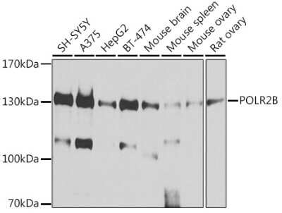 Western Blot: RPB2 AntibodyBSA Free [NBP2-93593]