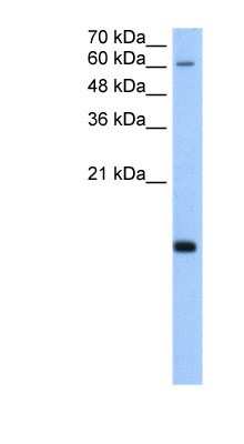 Western Blot: RPB8 Antibody [NBP1-53016]