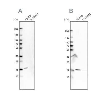 Western Blot: RPB8 Antibody [NBP2-76548]