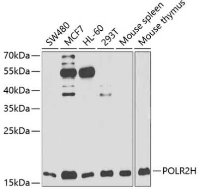 Western Blot: RPB8 AntibodyBSA Free [NBP2-93995]