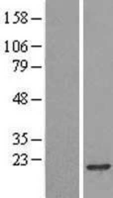 Western Blot: RPB8 Overexpression Lysate [NBL1-14585]