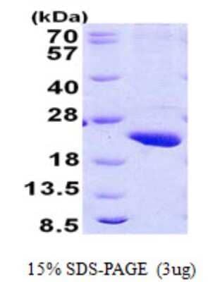 SDS-PAGE: Recombinant Human RPB8 His Protein [NBP2-23345]