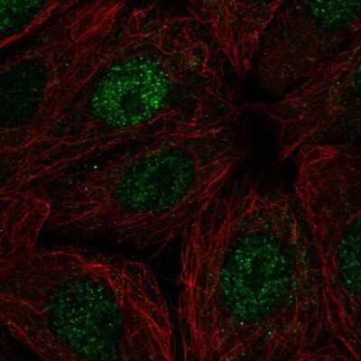 Immunocytochemistry/ Immunofluorescence: RPB9 Antibody [NBP2-58387]