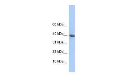 Western Blot: RPB9 Antibody [NBP2-88178]