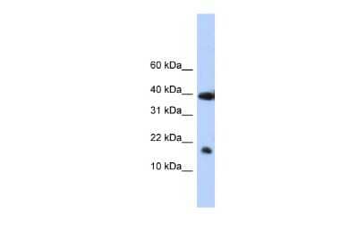 Western Blot: RPB9 Antibody [NBP2-88179]