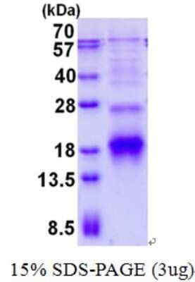 SDS-PAGE: Recombinant Human RPB9 His Protein [NBP2-23346]