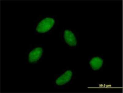 Immunocytochemistry/ Immunofluorescence: RPC62 Antibody [H00010623-B03P]
