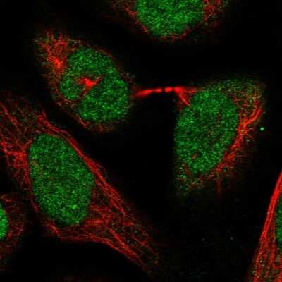 Immunocytochemistry/ Immunofluorescence: RPC62 Antibody [NBP1-87110]