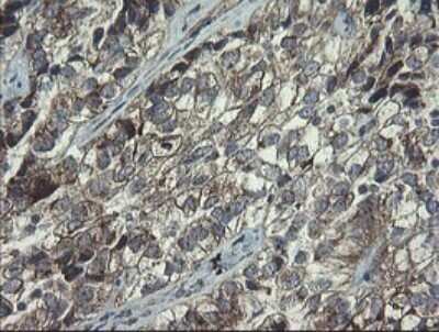 Immunohistochemistry: RPC62 Antibody (OTI2H1) - Azide and BSA Free [NBP2-73942]