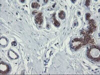 Immunohistochemistry: RPC62 Antibody (OTI2H1) - Azide and BSA Free [NBP2-73942]