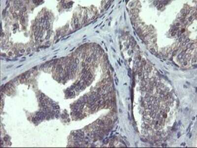 Immunohistochemistry: RPC62 Antibody (OTI2H1) - Azide and BSA Free [NBP2-73942]