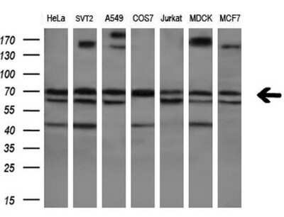 Western Blot: RPC62 Antibody (OTI2H1)Azide and BSA Free [NBP2-73942]
