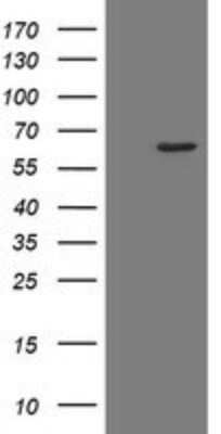 Western Blot: RPC62 Antibody (OTI2H1)Azide and BSA Free [NBP2-73942]