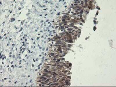 Immunohistochemistry: RPC62 Antibody (OTI2H1) [NBP2-45900]