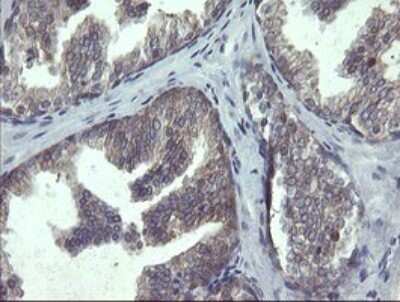 Immunohistochemistry: RPC62 Antibody (OTI2H1) [NBP2-45900]