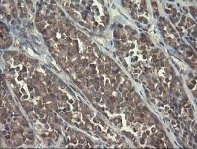 Immunohistochemistry: RPC62 Antibody (OTI2H1) [NBP2-45900]