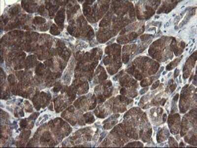 Immunohistochemistry: RPC62 Antibody (OTI2H1) [NBP2-45900]