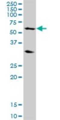 Western Blot: RPC62 Antibody [H00010623-B03P]