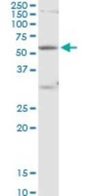 Western Blot: RPC62 Antibody [H00010623-B03P]