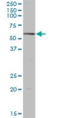 Western Blot: RPC62 Antibody [H00010623-B03P]