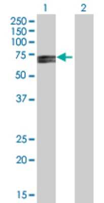 Western Blot: RPC62 Antibody [H00010623-B03P]