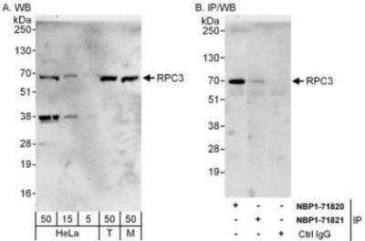 Western Blot: RPC62 Antibody [NBP1-71821]