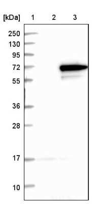 Western Blot: RPC62 Antibody [NBP1-87111]