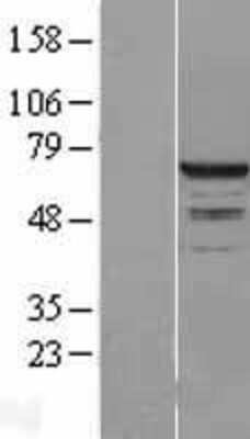 Western Blot: RPC62 Overexpression Lysate [NBL1-14591]