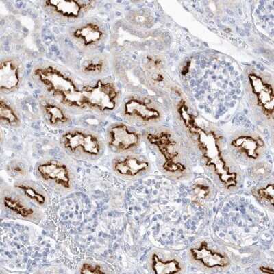 Immunohistochemistry: RPE Antibody [NBP2-32668]