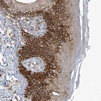 Immunohistochemistry-Paraffin: RPE Antibody [NBP1-86286]