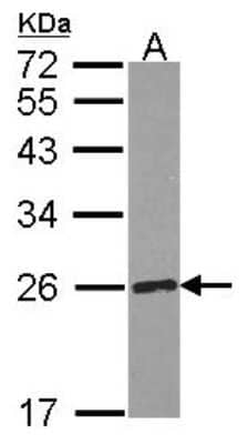 Western Blot: RPE Antibody [NBP2-20208]